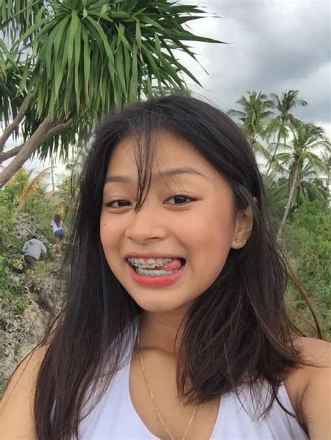 Pinay Na Naka Brace Porn Videos .